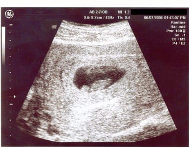 First Ultrasound